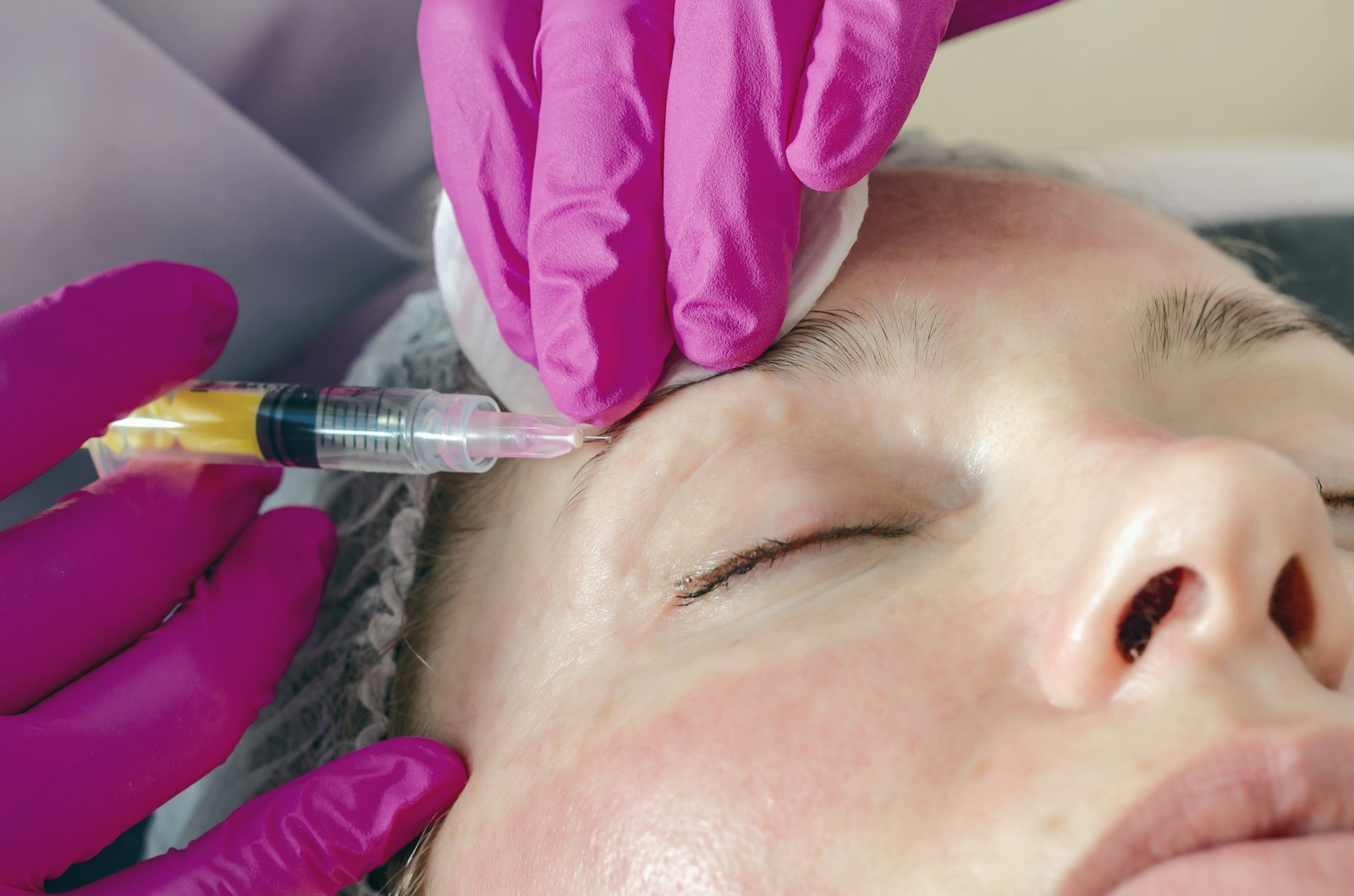 Person receiving an aesthetic injection in the forehead