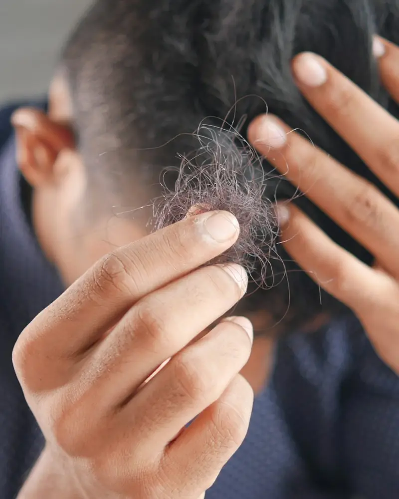 Man checking his receding hairline