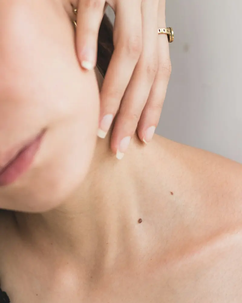 Soft skin along the jaw and neck