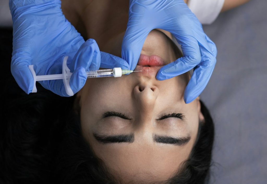 Dermal filler being injected into the lips