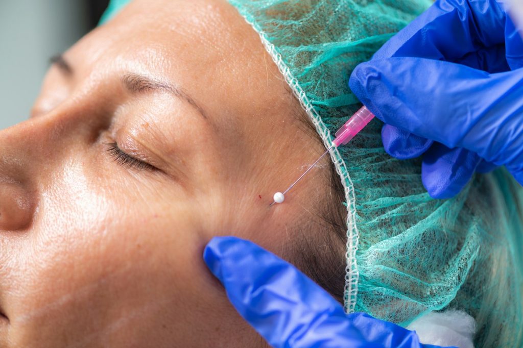Aesthetic injection treatment on the face