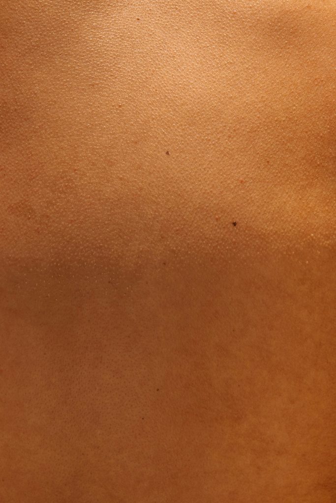 Close-up of skin with visible pores