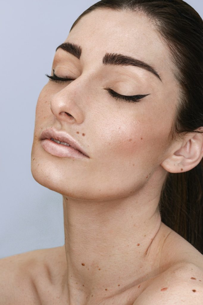 Woman with freckles across her face and shoulders